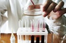 Какие есть анализы крови на ферменты печени?