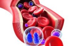 Показатели лимфолейкоза при анализе крови