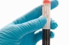 Как расшифровать значение ГГТ в крови при биохимическом анализе?