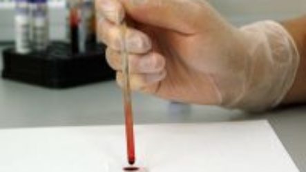 Расшифровка гематологического анализа крови