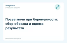 Посев мочи при беременности: сбор образца и оценка результата