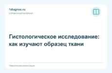 Гистологическое исследование: как изучают образец ткани