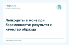 Лейкоциты в моче при беременности: результат и качество образца