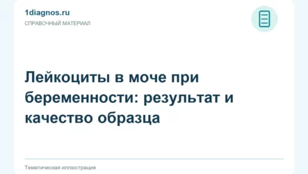Лейкоциты в моче при беременности: результат и качество образца
