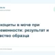 Лейкоциты в моче при беременности: результат и качество образца