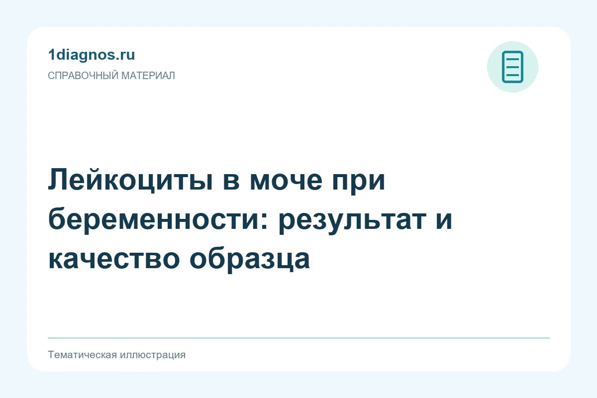 Лейкоциты в моче при беременности: результат и качество образца — тематическая иллюстрация