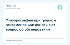 Флюорография при грудном вскармливании: как решают вопрос об обследовании