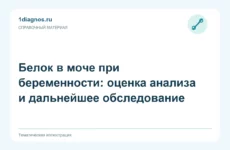 Белок в моче при беременности: оценка анализа и дальнейшее обследование