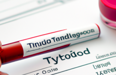 Анализ крови на функцию щитовидной железы: определение уровня тиреоидных гормонов