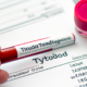Анализ крови на функцию щитовидной железы: определение уровня тиреоидных гормонов
