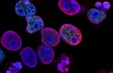 Анализ крови при онкологии: как маркеры могут помочь в борьбе с раком