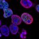 Анализ крови при онкологии: как маркеры могут помочь в борьбе с раком