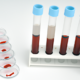 Клинический анализ сыворотки крови: интерпретация биохимических параметров