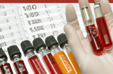 Клинический анализ крови: ключевые параметры и их значения