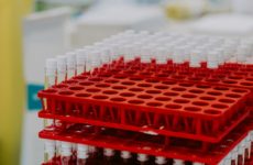 Лабораторная диагностика: анализы и методы изучения биоматериала