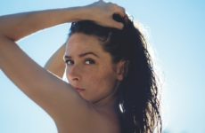 Варикозное расширение вен: влияние на кожу и способы лечения