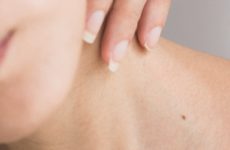 Косметология и дерматология: как выбрать безопасные процедуры для кожи