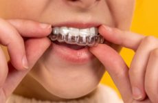 Как избежать проблем с зубами: советы стоматологов
